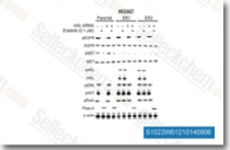 lexapro for pmdd lexapro for pmdd