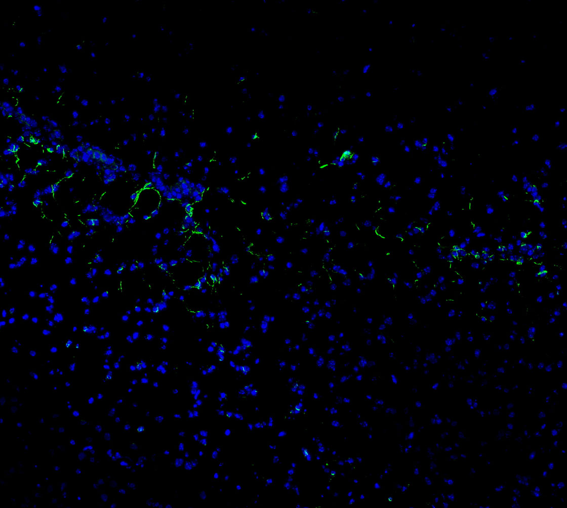 F0031-IF-Mouse-Brain