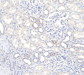 F0064-IHC1