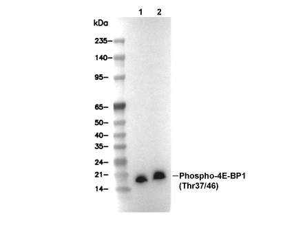 Phospho-4E-BP1 (Thr37/46) Antibody [E9G24] WB