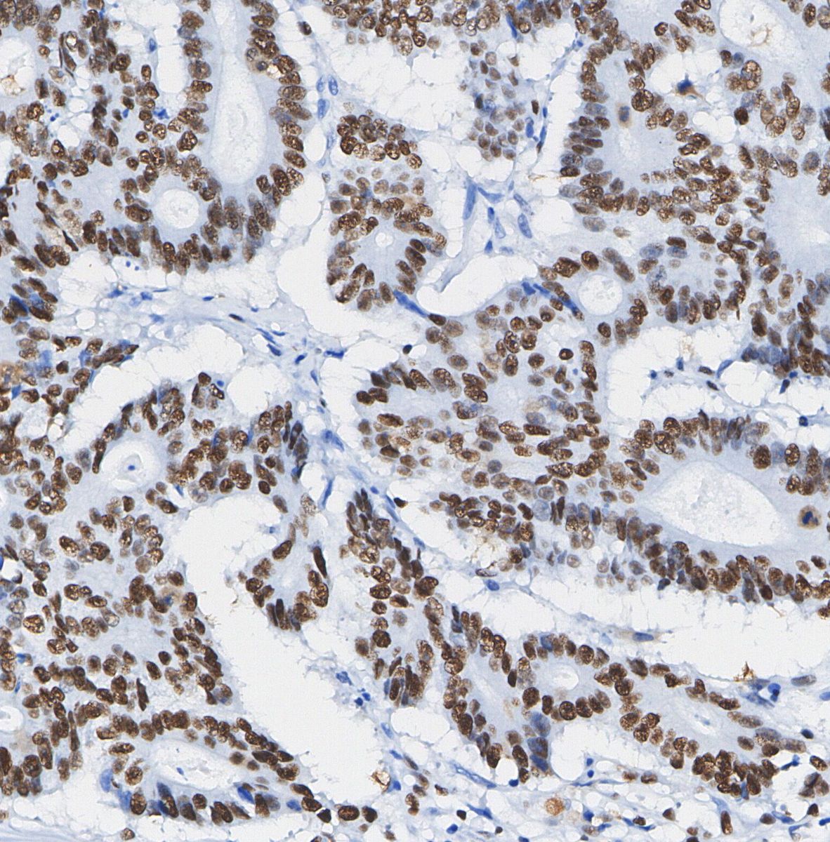 F0290-IHC1