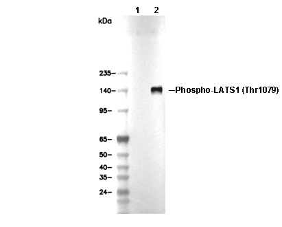 Phospho-LATS1 (Thr1079) Antibody [F2E16] WB
