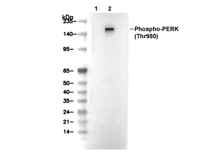 Phospho-PERK (Thr980) Antibody [E16F3] WB