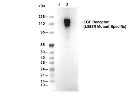 EGF Receptor (L858R Mutant Specific) Antibody [B13L21] WB