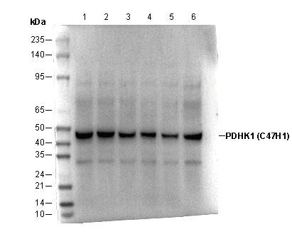 PDHK1 Antibody [J6P24] WB