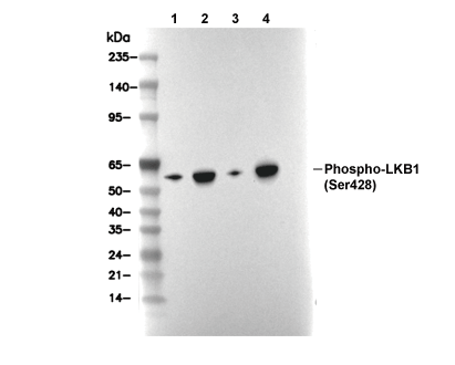 Phospho-LKB1 (Ser428) Antibody [H12K23] WB