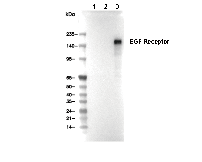 EGF Receptor (E746-A750del Specific) Antibody [L24P14] WB