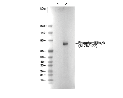 Phospho-IKK&alpha;/&beta; (S176/177) Antibody [L19G16] WB