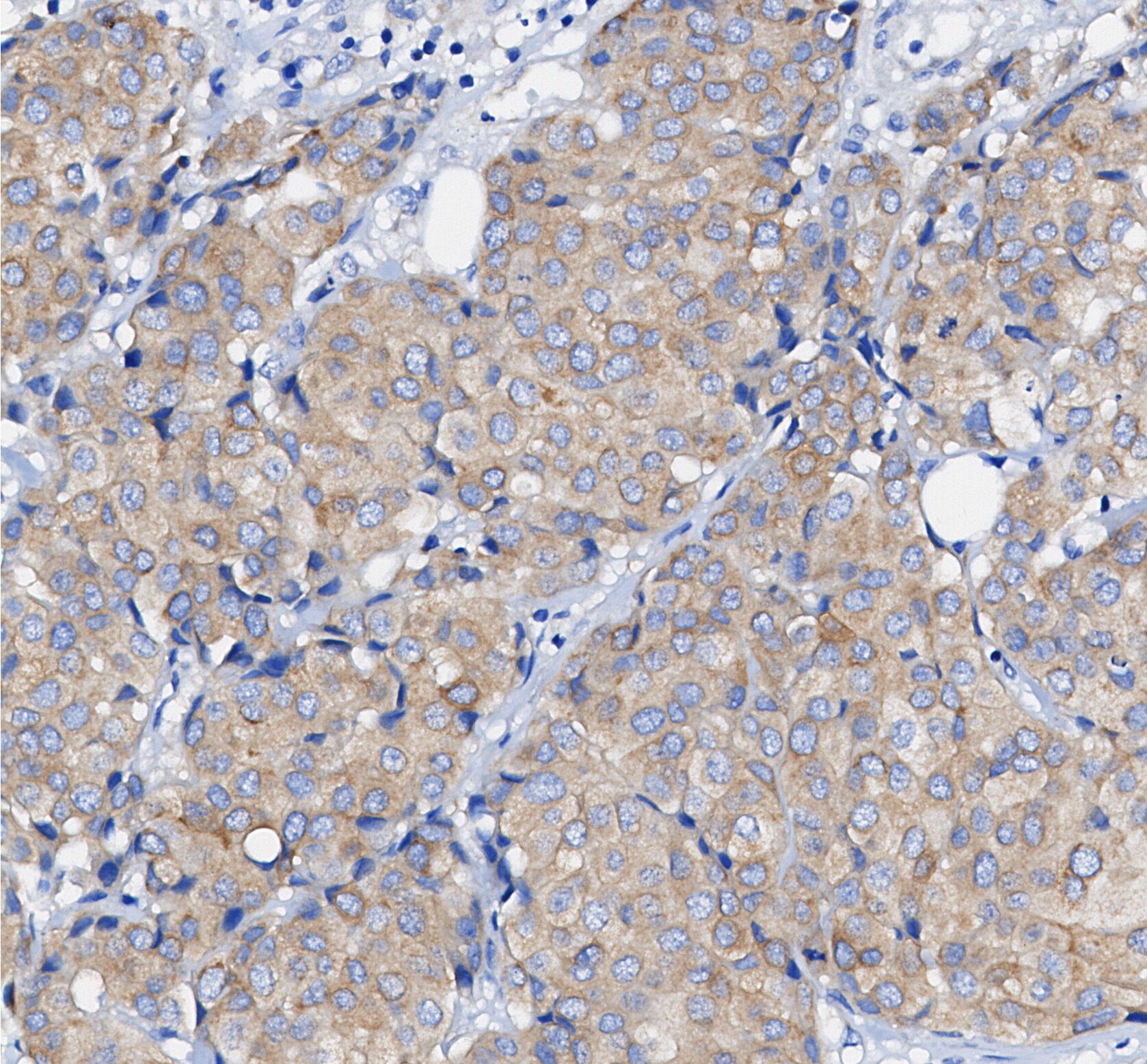 F0459-IHC1