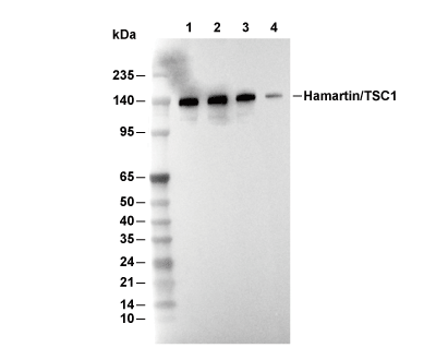 Hamartin/TSC1 Antibody [N1E19] WB