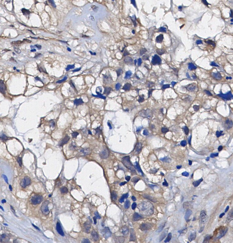 F0592-IHC1