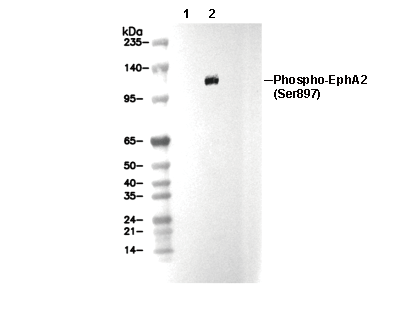 Phospho-EphA2 (Ser897) Antibody [G4G3] WB