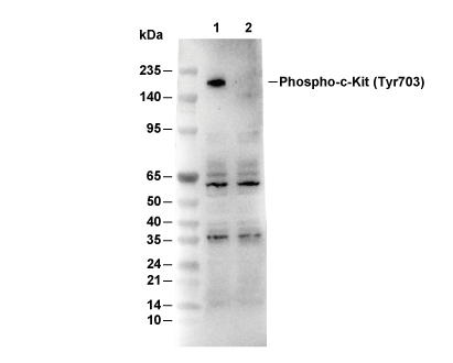 Phospho-c-Kit (Tyr703) Antibody [K16C2] WB
