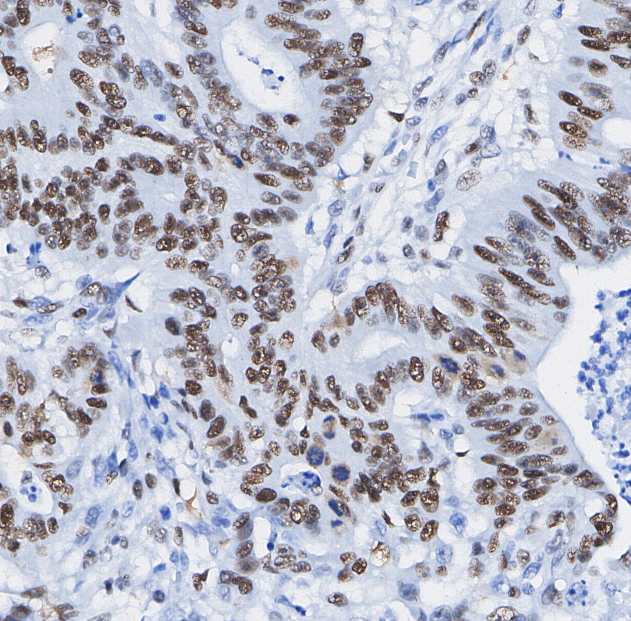 F0790-IHC1