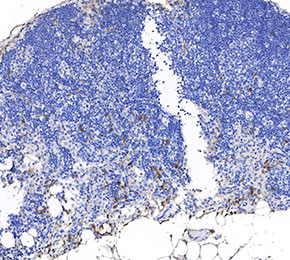 F0810-IHC1