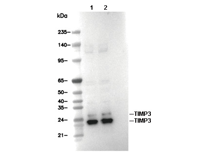 TIMP3 Antibody [C11F19] WB