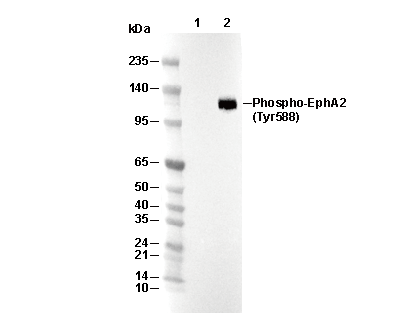 Phospho-EphA2 (Tyr588) Antibody [F13K2] WB