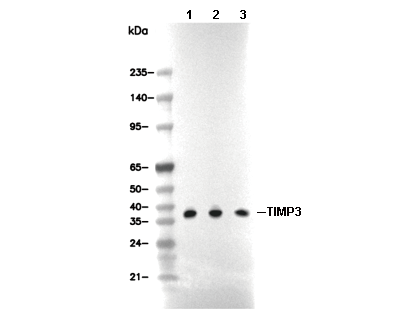 RagB Antibody [F4J9] WB
