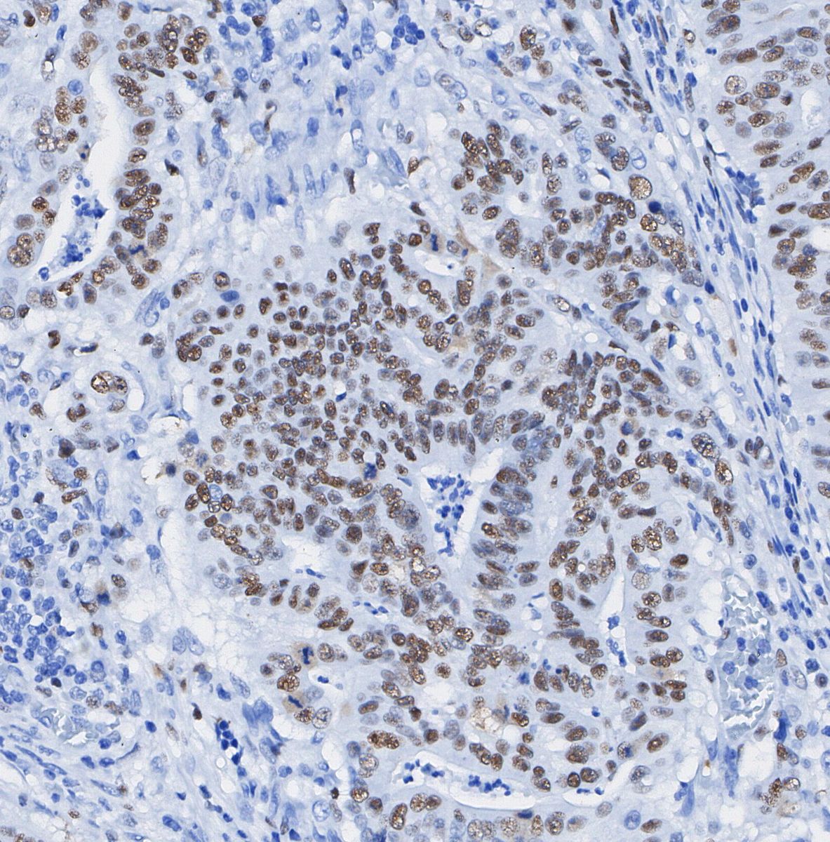 F0896-IHC1