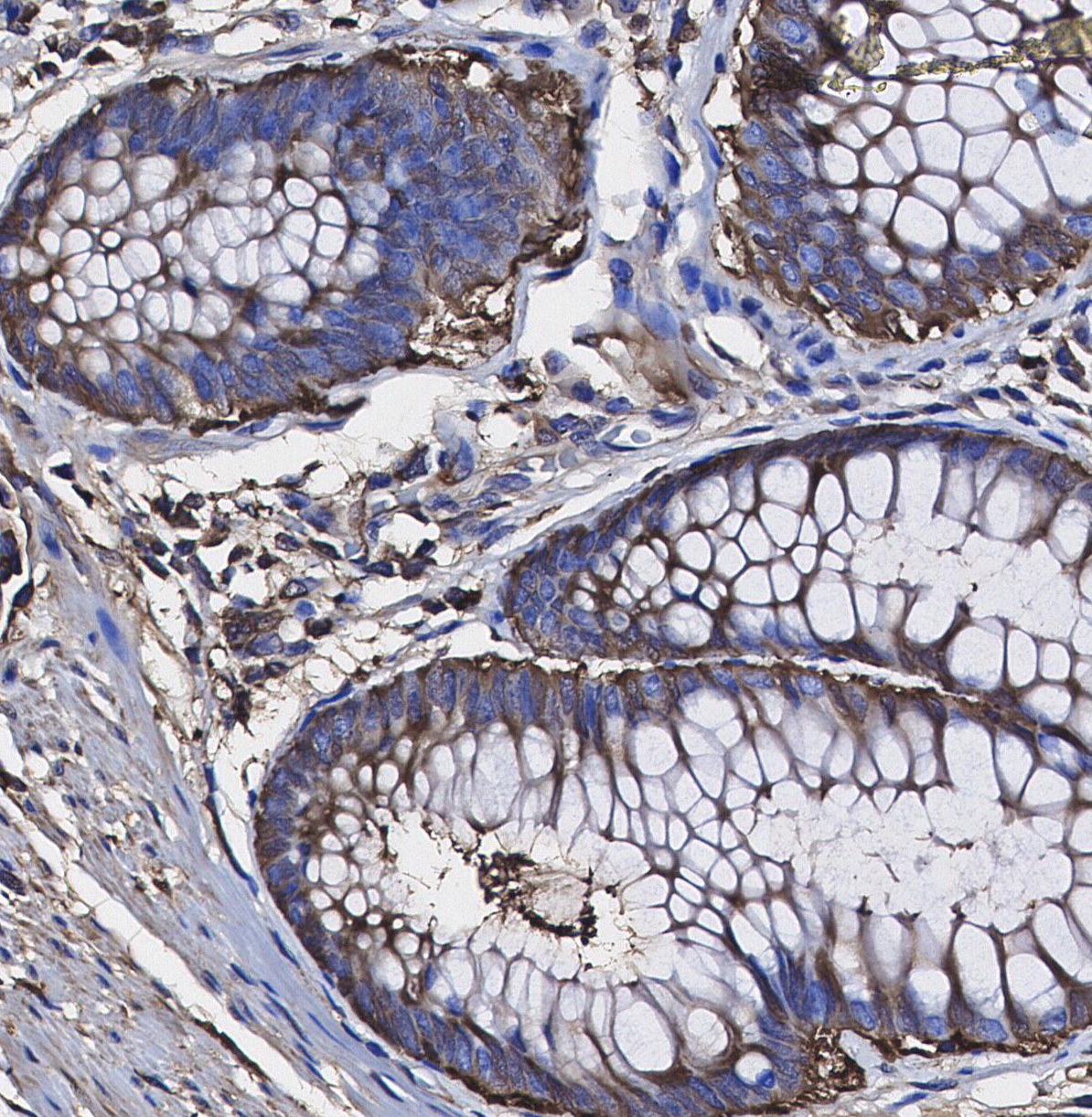 F0927-IHC1