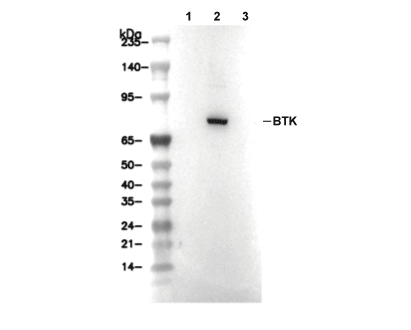 Phospho-BTK (Tyr223) Antibody [H3N9] WB
