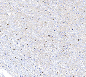 F0978-IHC1