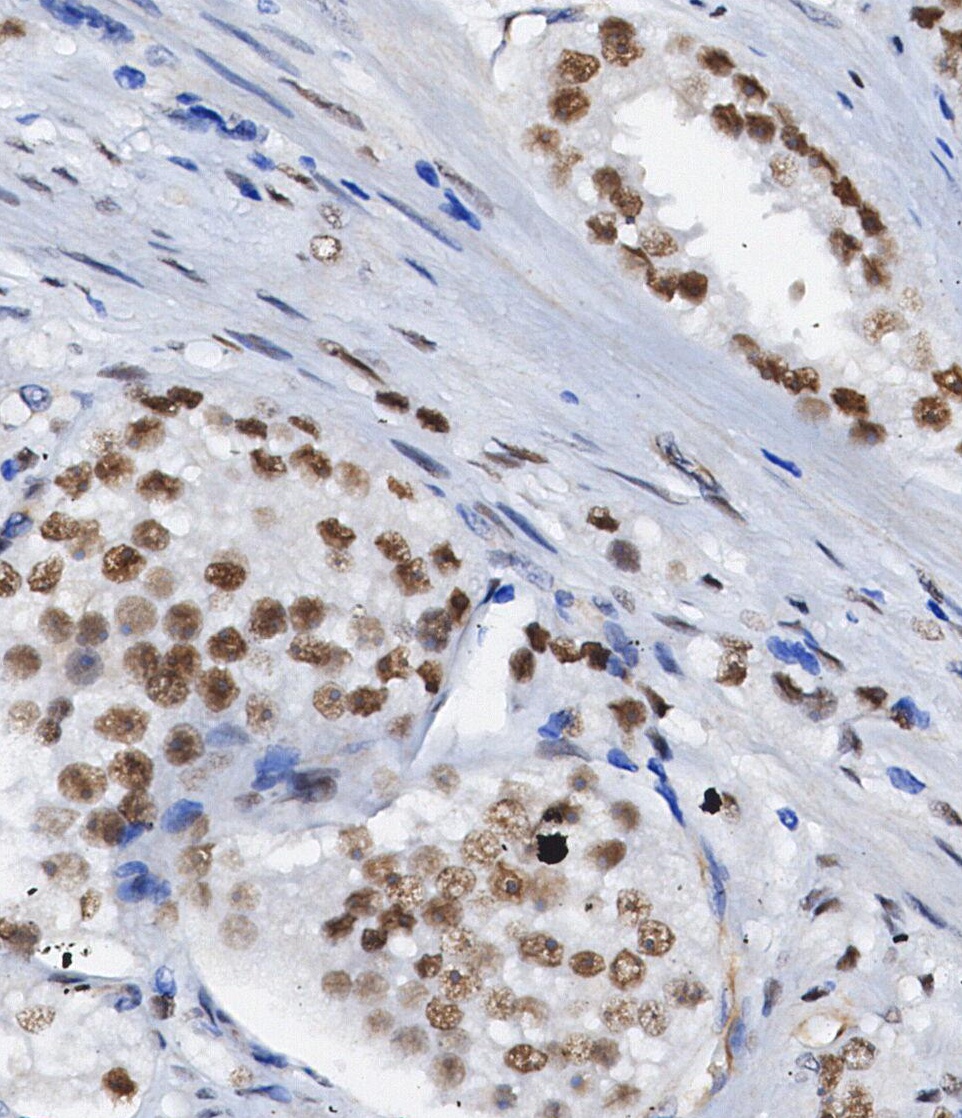 F0985-IHC1