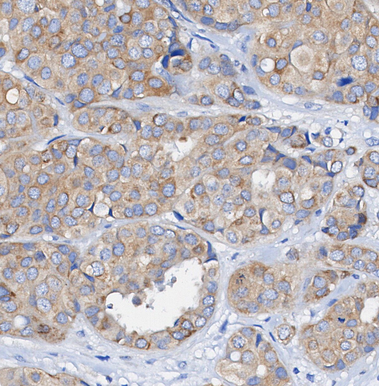 F0995-IHC1