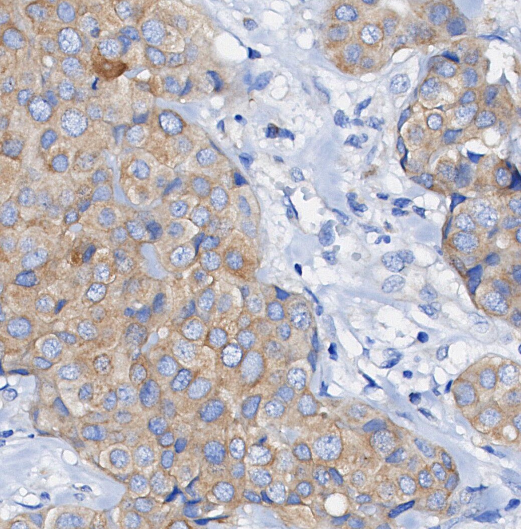 F1011-IHC1