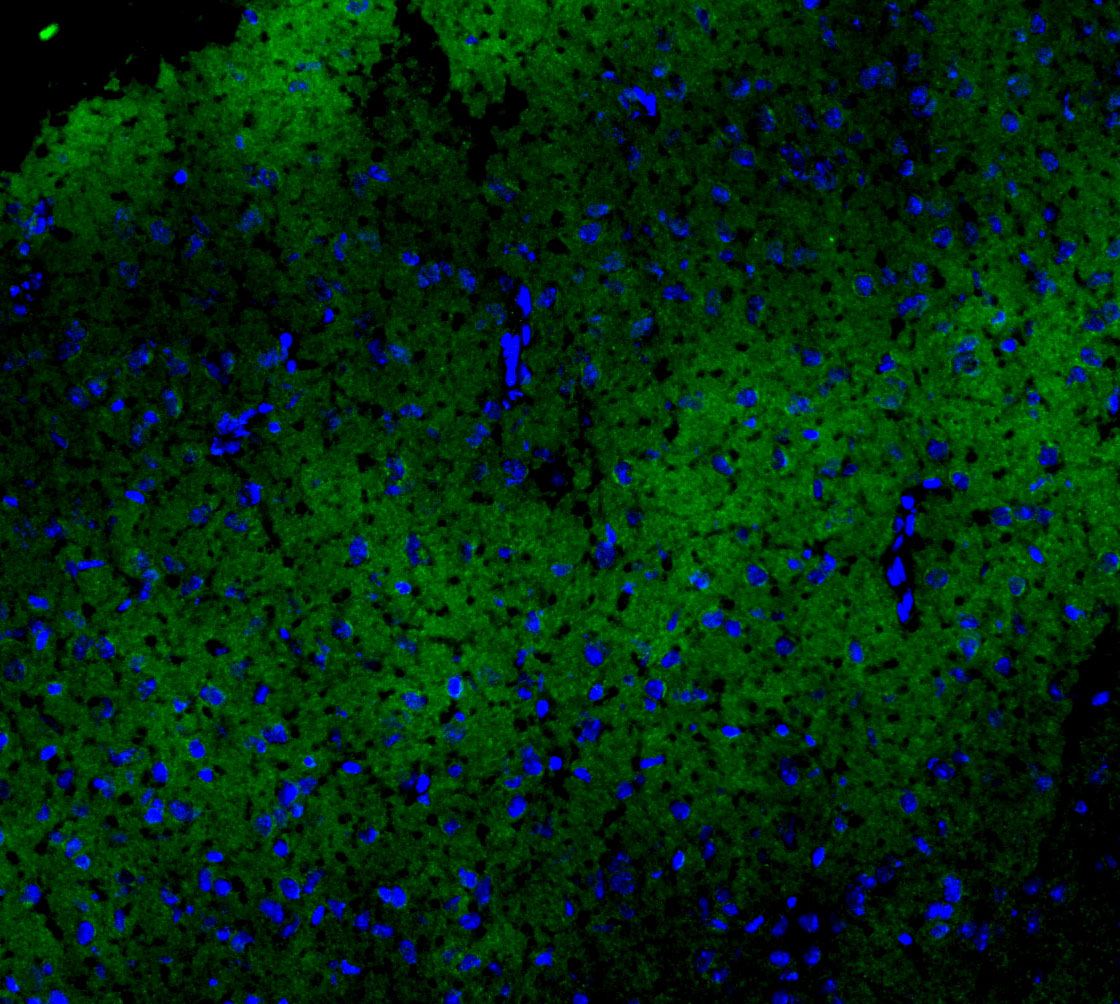 F1020-IF-Mouse-Brain