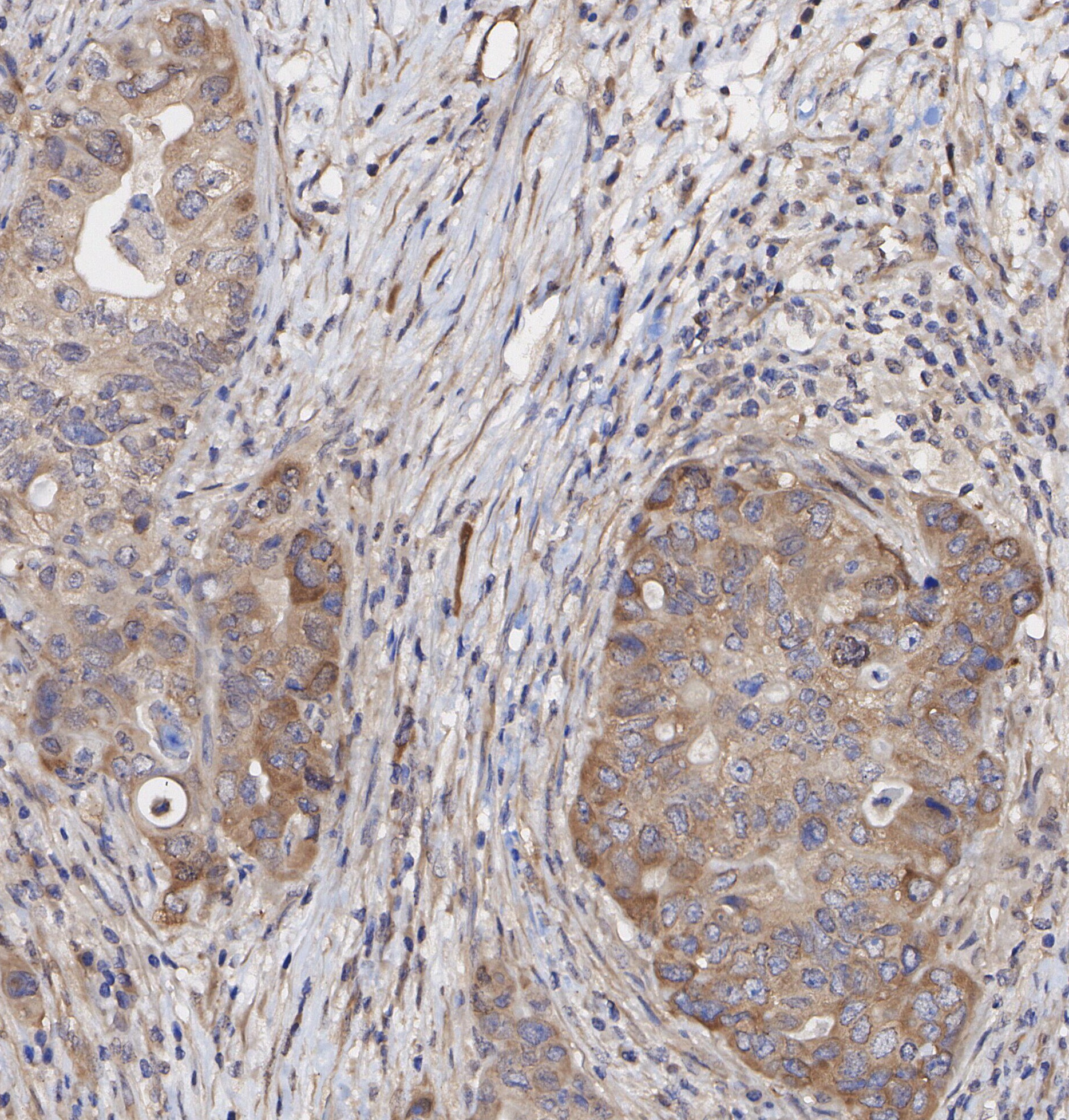 F1077-IHC1