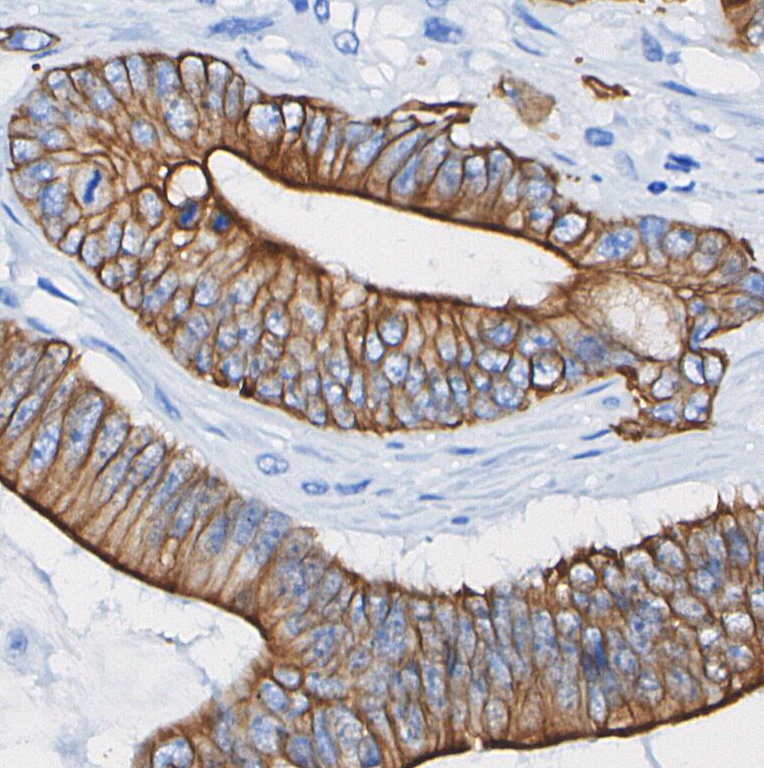 F1082-IHC1