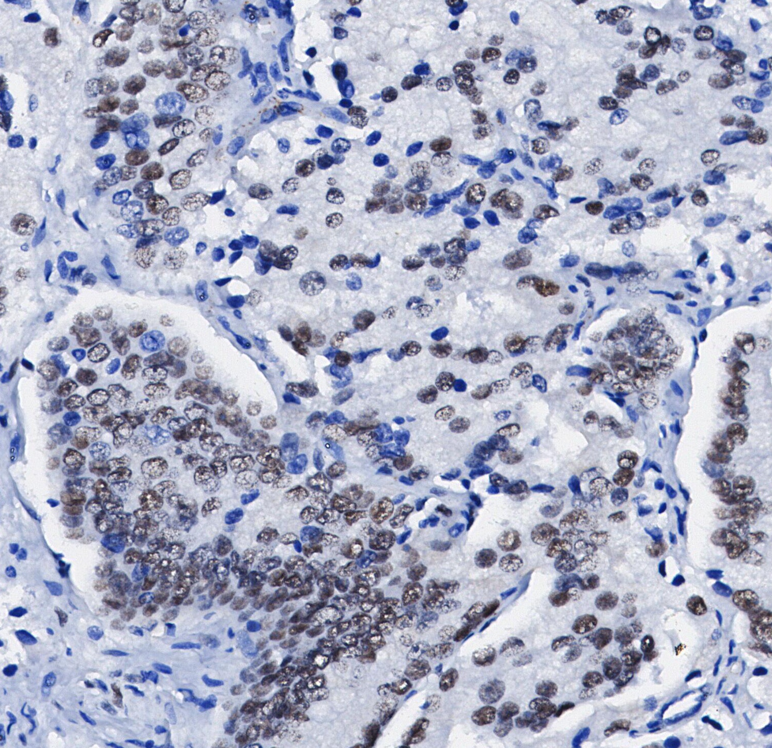 F1099-IHC1