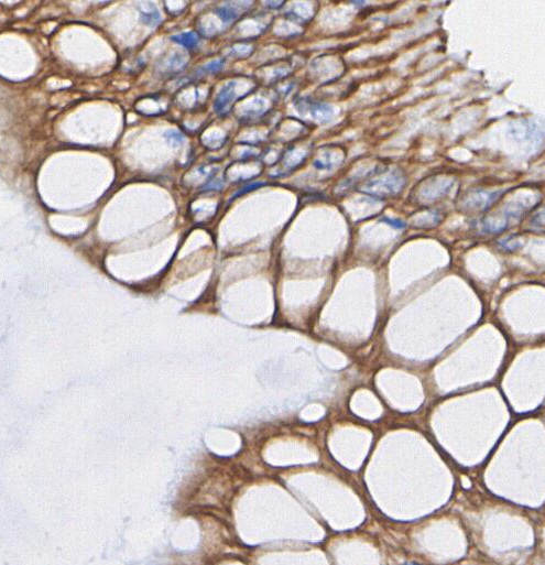 F1145-IHC1