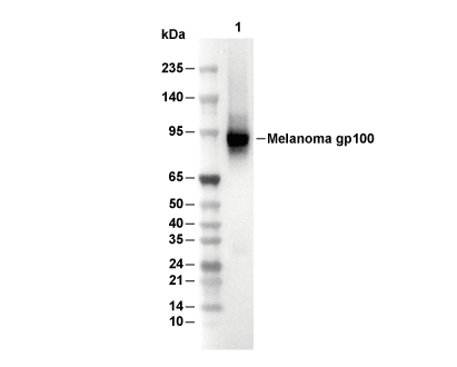 Melanoma gp100 Antibody [K14B19] WB