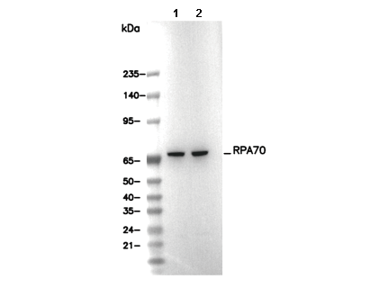 RPA70 Antibody [J13K13] WB