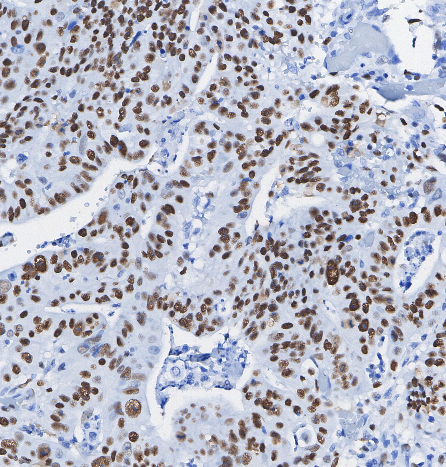 F1235-IHC1