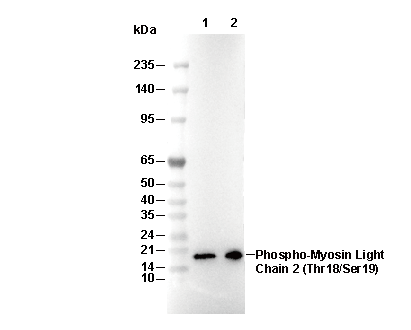 Phospho-Myosin Light Chain 2 (Thr18/Ser19) Antibody [C13P19] WB