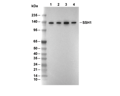 SSH1 Antibody [K8K10] WB
