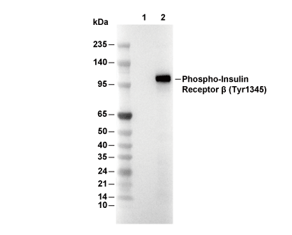 Phospho-Insulin Receptor &beta; (Tyr1345) Antibody [L11H12] WB