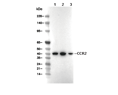 CCR2 Antibody [F5J21] WB
