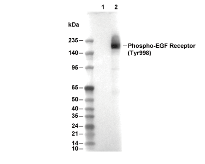Phospho-EGF Receptor (Tyr998) Antibody [L7A22] WB