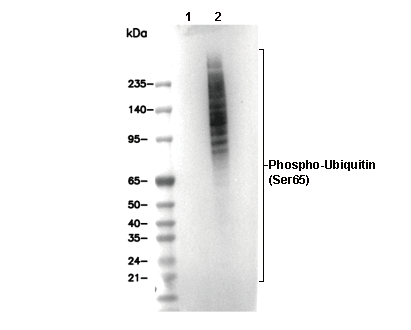 Phospho-Ubiquitin (Ser65) Antibody [C22F3] WB