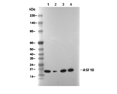 ASF1B Antibody [N9K17] WB