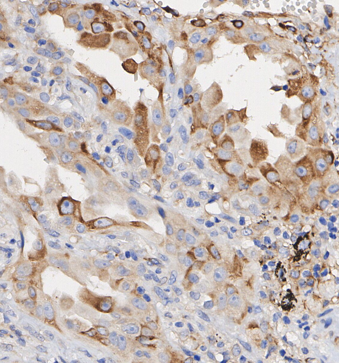 F1541-IHC1