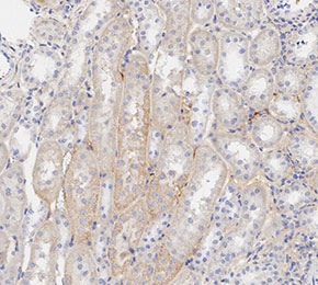 F1546-IHC1