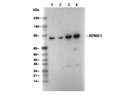 KPNB1 Antibody [K10N6] WB