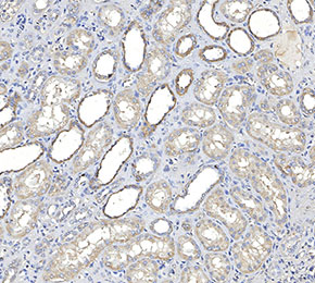 F1579-IHC1