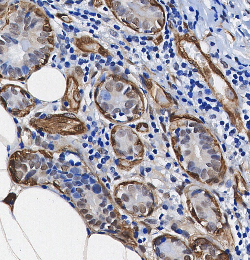 F1596-IHC1