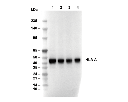 HLA A Antibody [F17H17] WB